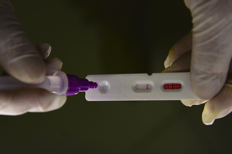 Hospitalizações por covid-19 mantêm tendência de alta nos estados