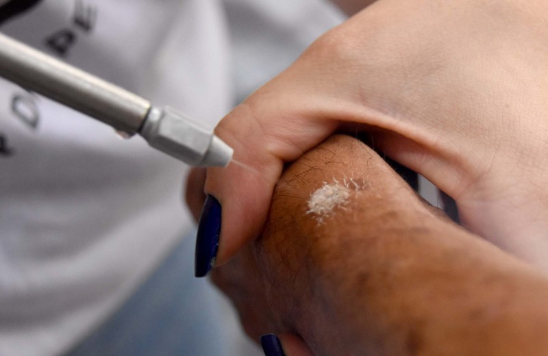 Força-tarefa de dermatologia atende mais de 500 pacientes